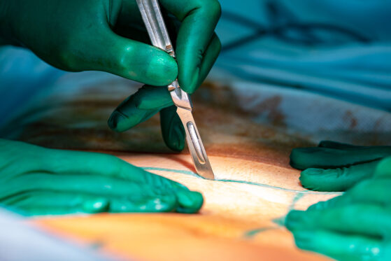 The Weight of a Scalpel: A Surgeon's Reflection on Failure